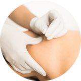 Service - Dry Needling Service - Dry Needling
